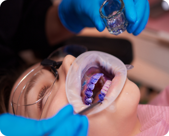 détartrage-geneve-photo-intro