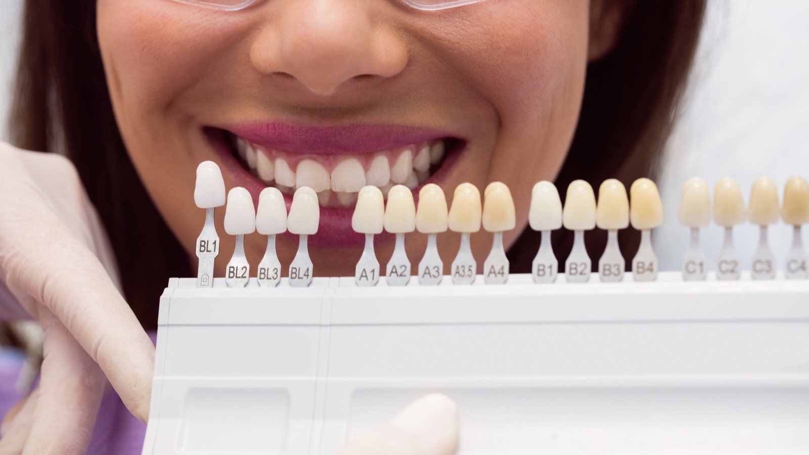 Dentiste comparant la teinte des dents d une patiente