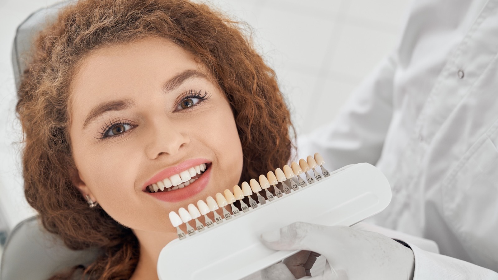 Choix de la teinte des dents pour des facettes dentaires